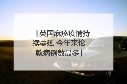 英国麻疹疫情持续蔓延 今年来伦敦病例数最多