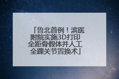 鲁北首例！滨医附院实施3D打印全距骨假体并人工全踝关节置换术
